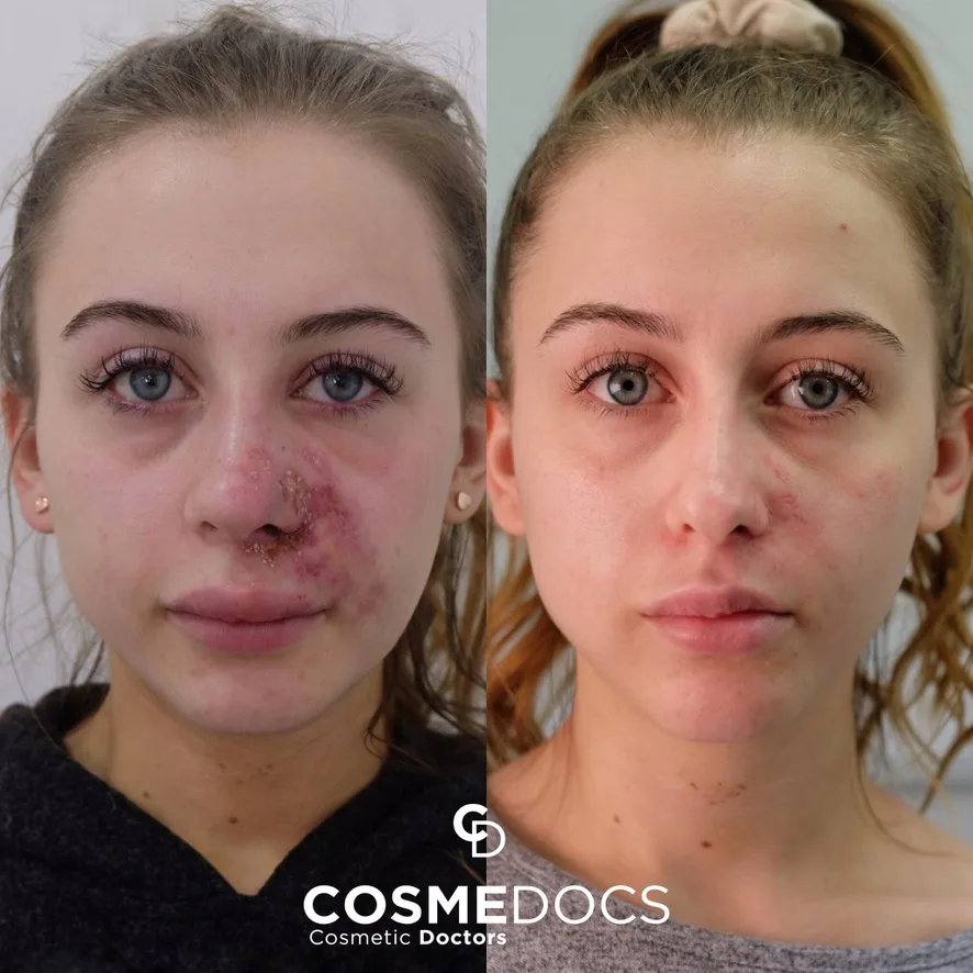 Correction de complications - Cosmedocs
