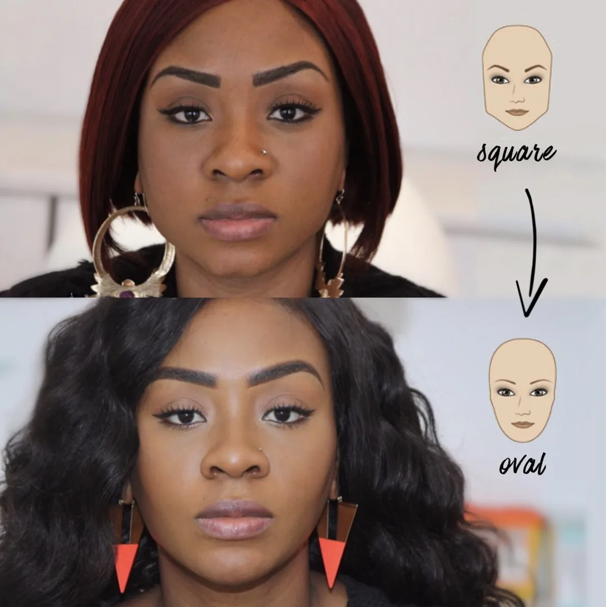 Facial contouring before and after — square face transformed to oval through masseter reduction