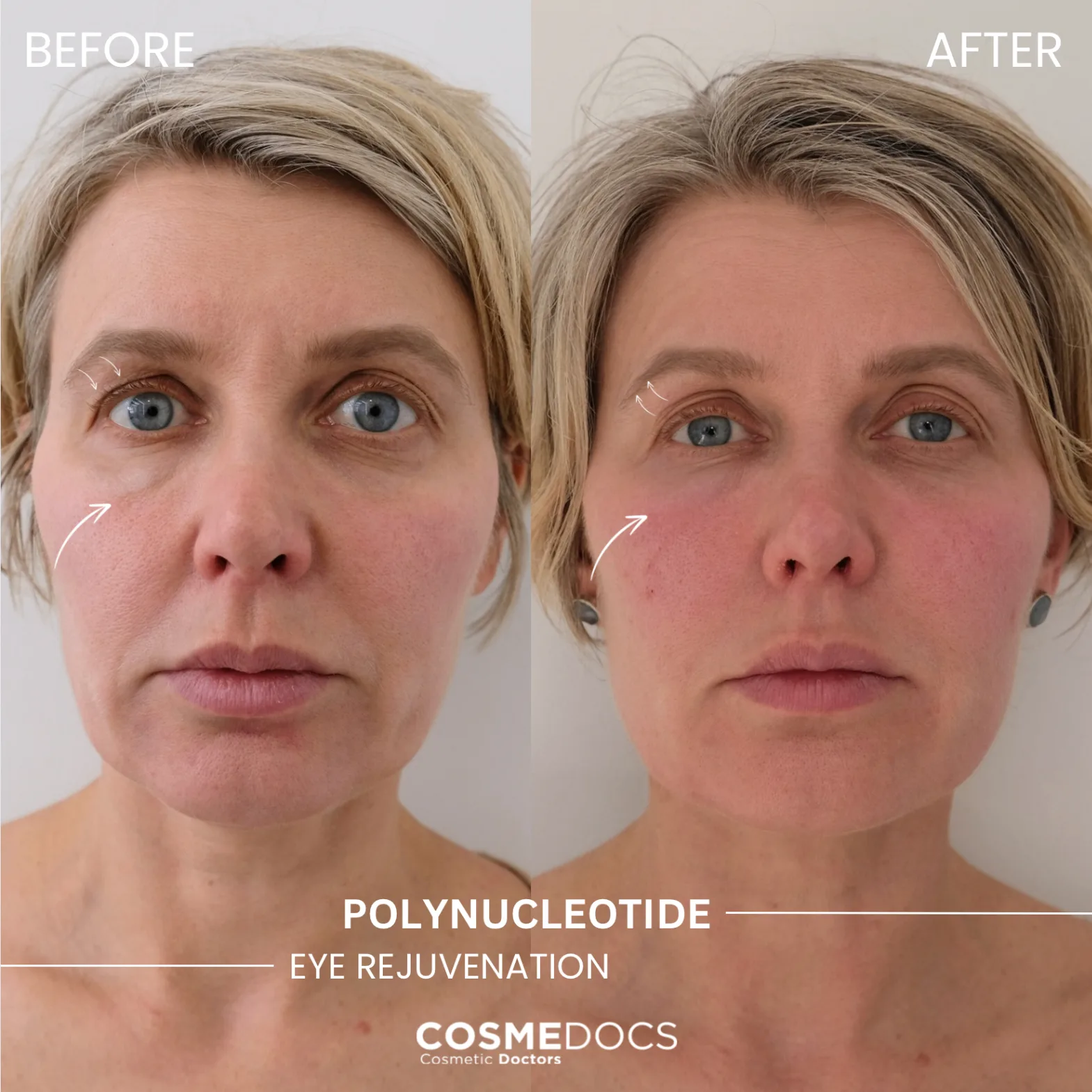 Treatment results
