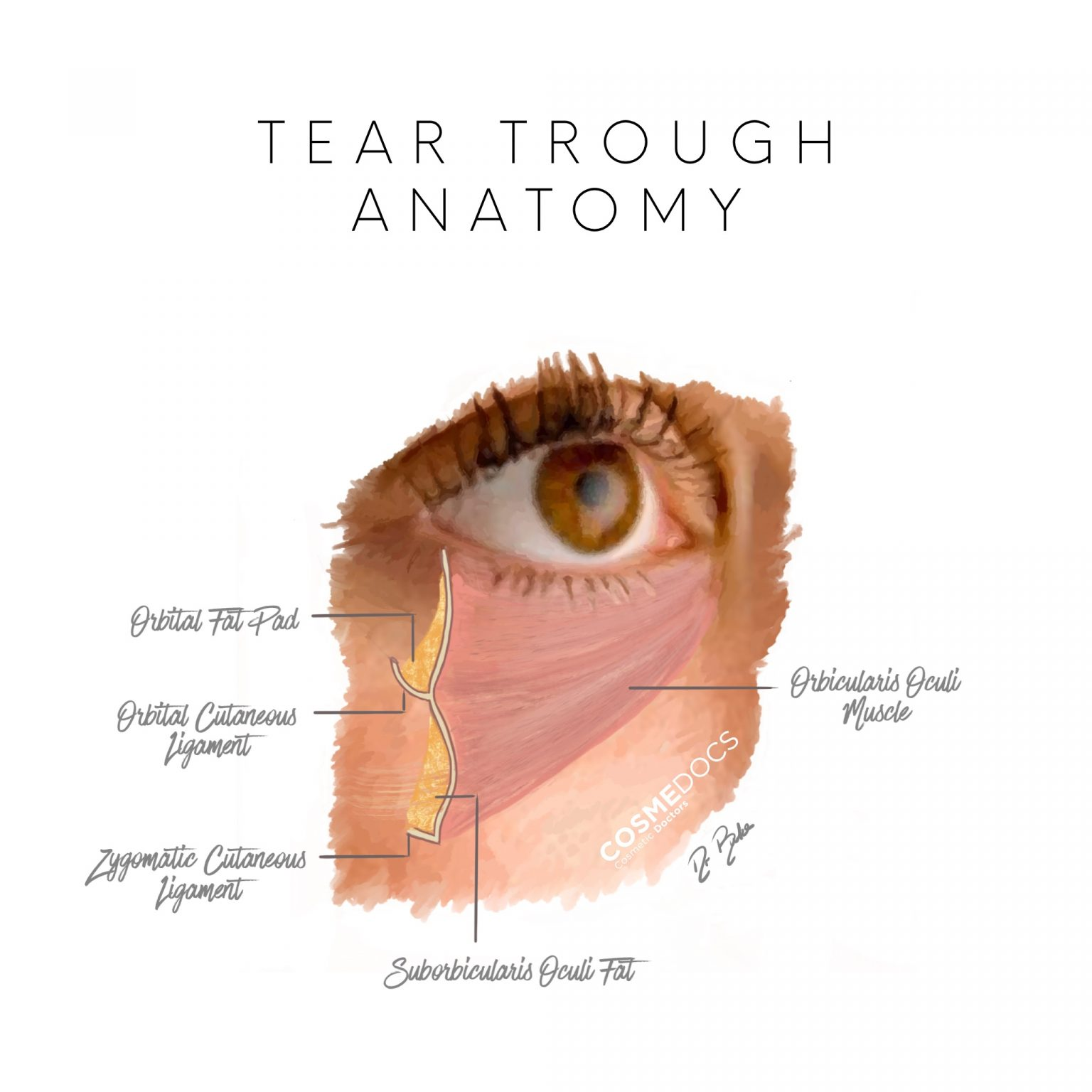 Tear trough anatomy illustration showing orbital fat pad, orbital cutaneous ligament, zygomatic cutaneous ligament, orbicularis oculi muscle and suborbicularis oculi fat
