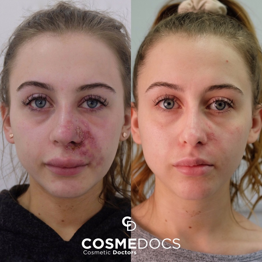 Correction de complications - Cosmedocs