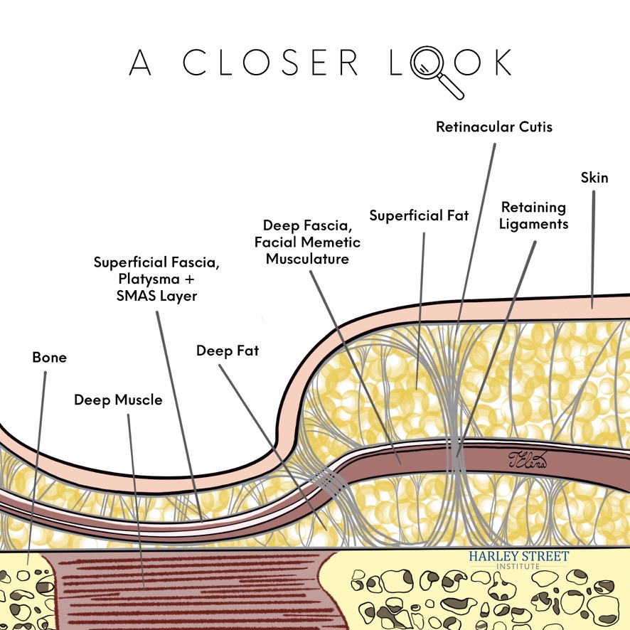 Detailed anatomical diagram showing skin layers including epidermis, dermis, retinacular cutis, and facial structures