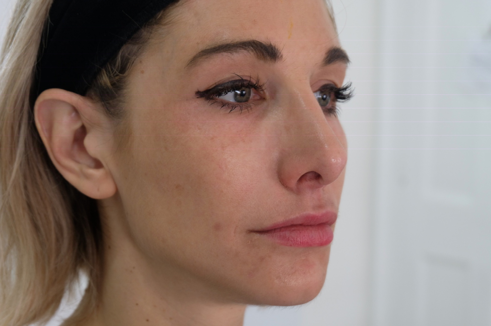 Final results - enhanced volume and contour