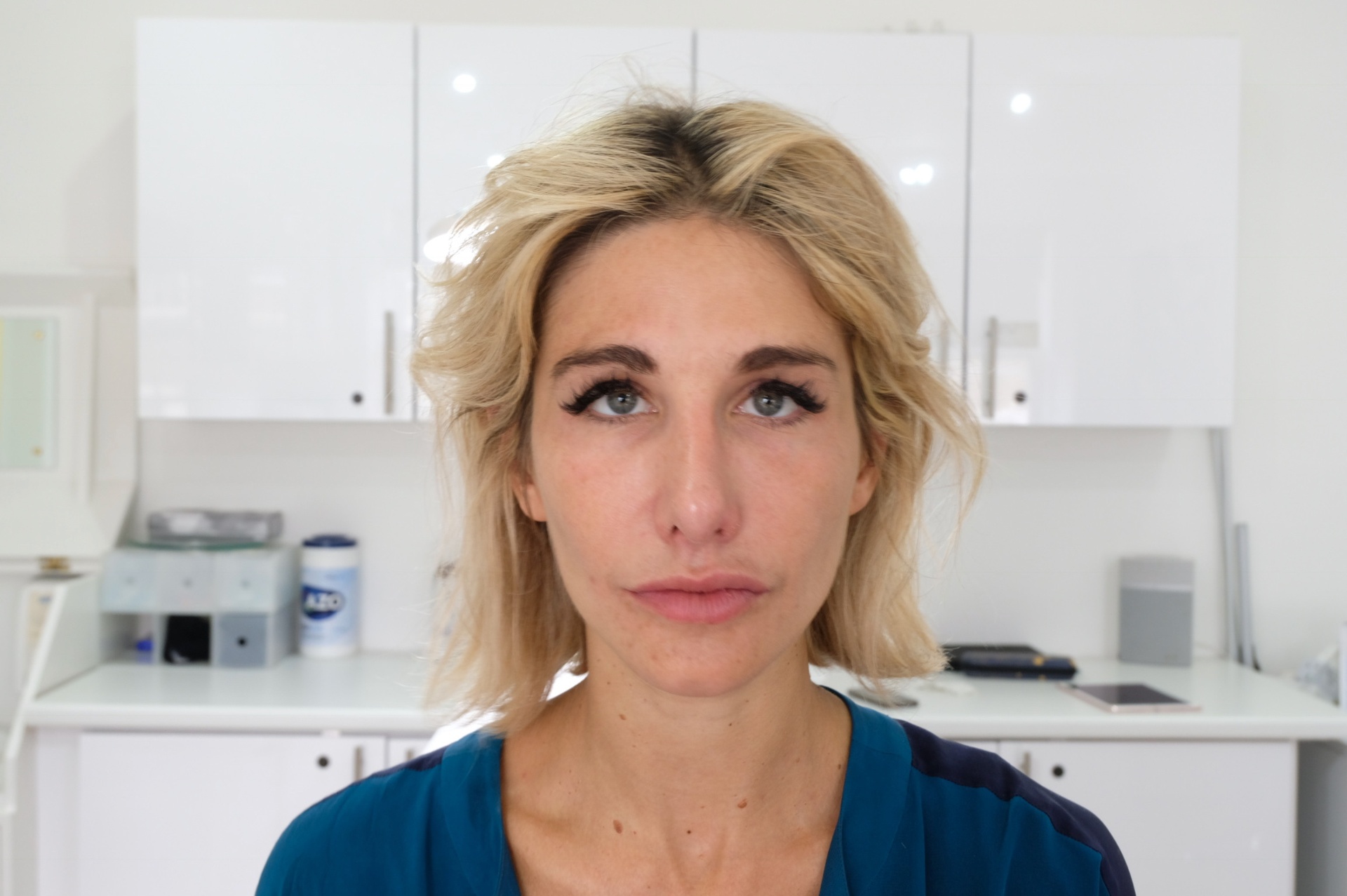 Natural enhancement maintaining facial harmony