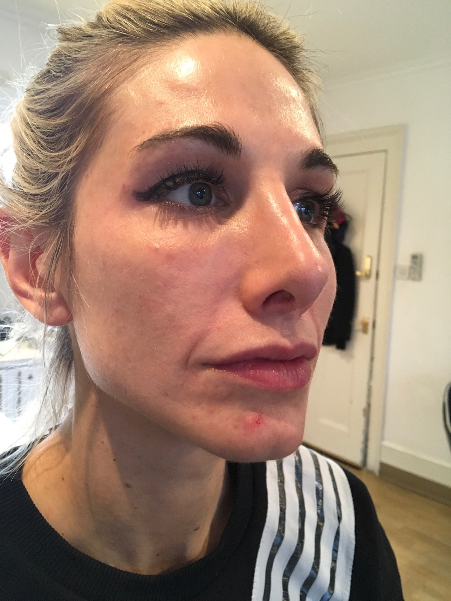 Initial consultation showing natural aging signs