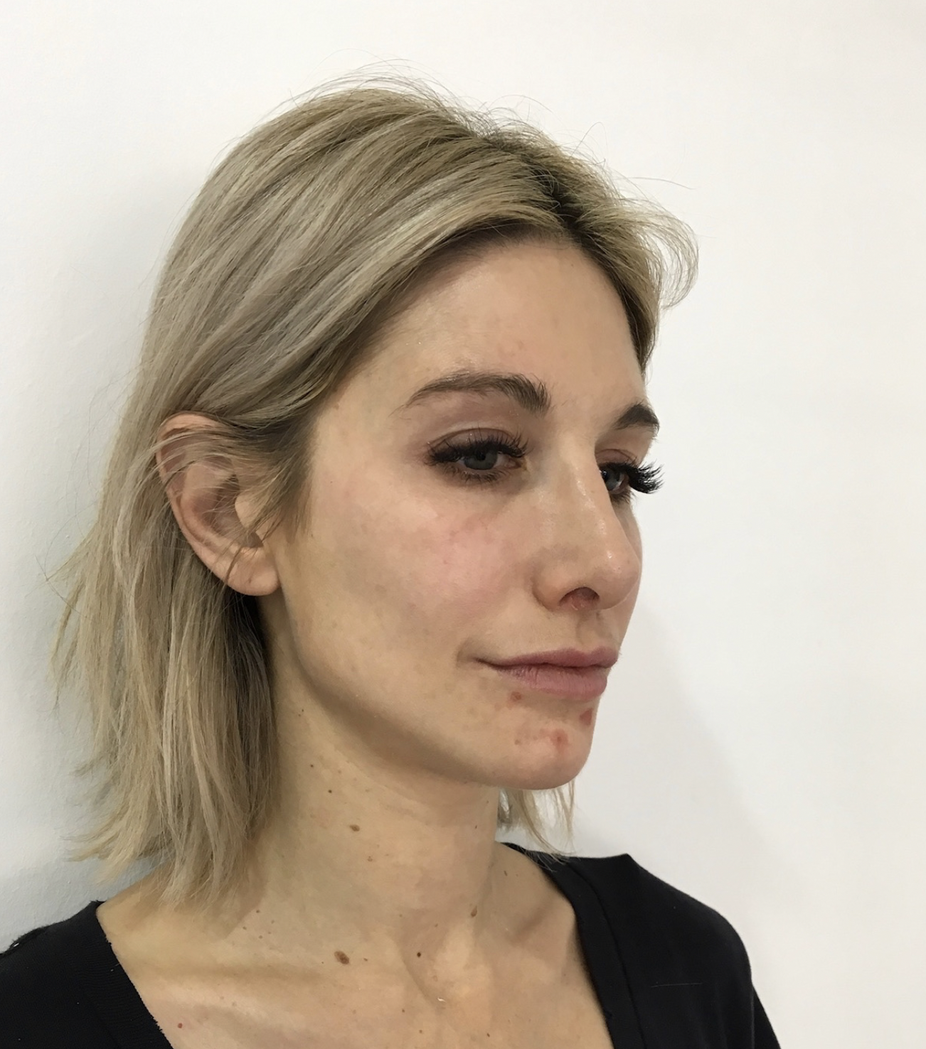 Mid-treatment progress - 6 months in