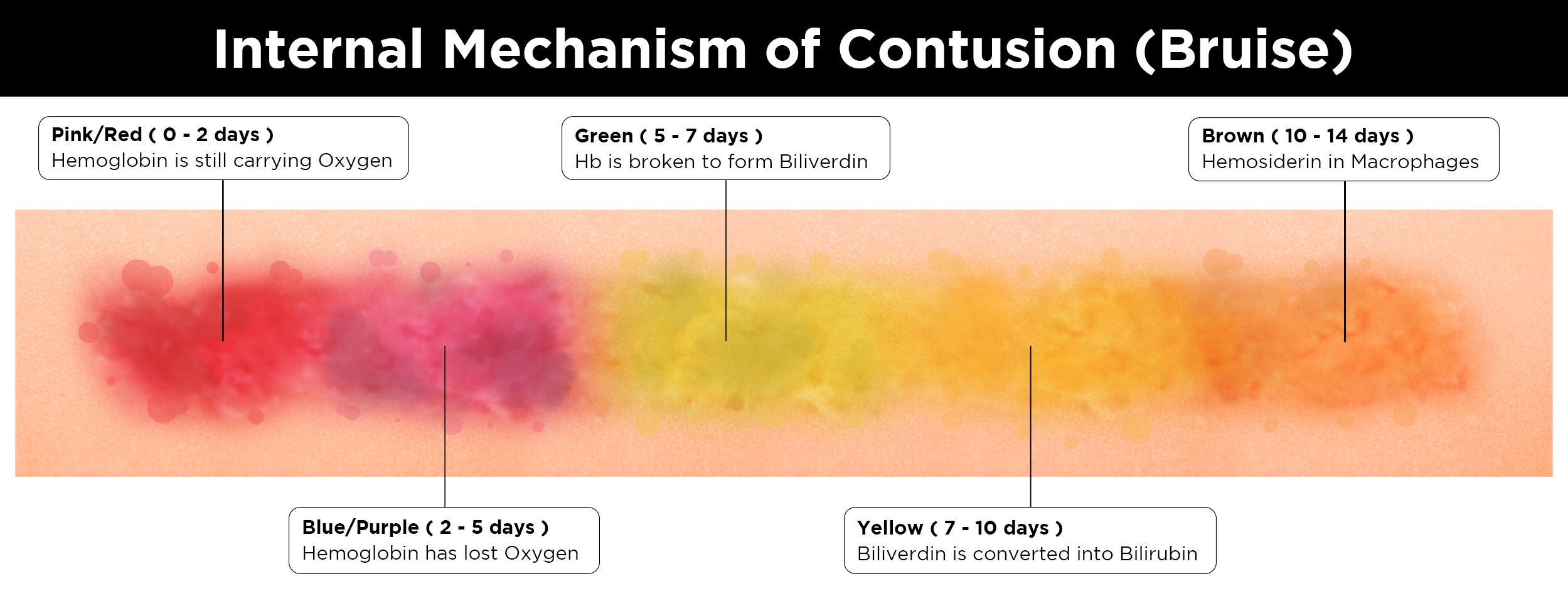 Stages Of Bruises Healing