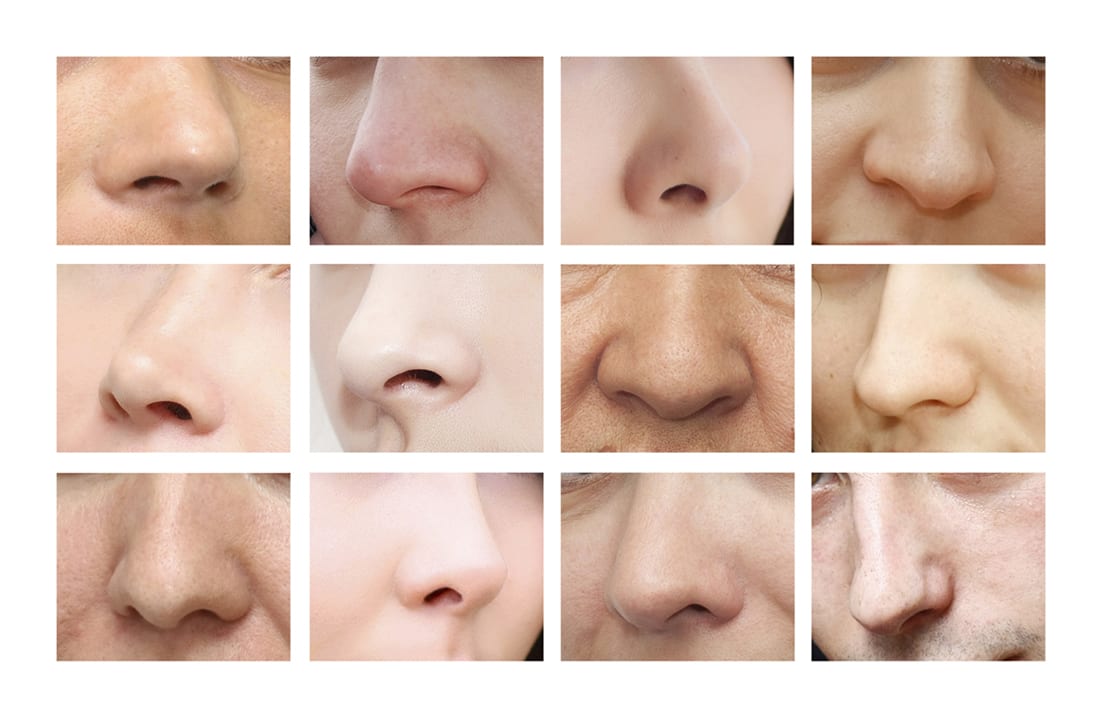 14 different nose shapes