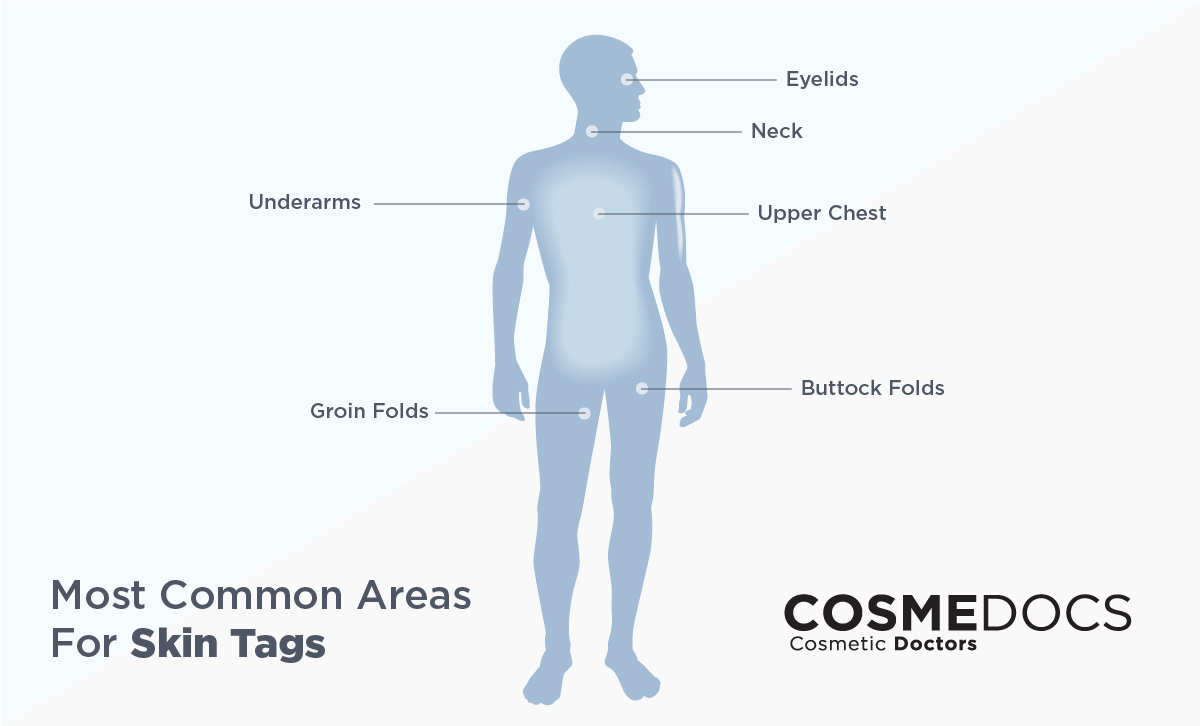 tag-on-body-parts