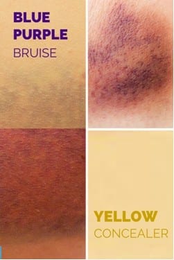 Purple Bruise