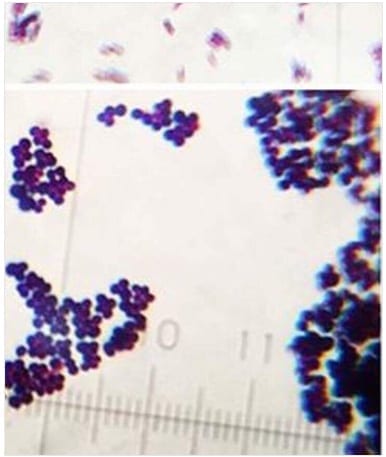 gram-stain