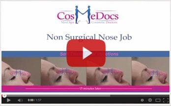 Microdermabrasion Video Icon