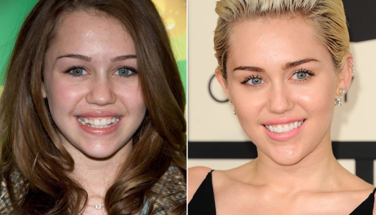 miley-cyrus-before-and-after-1