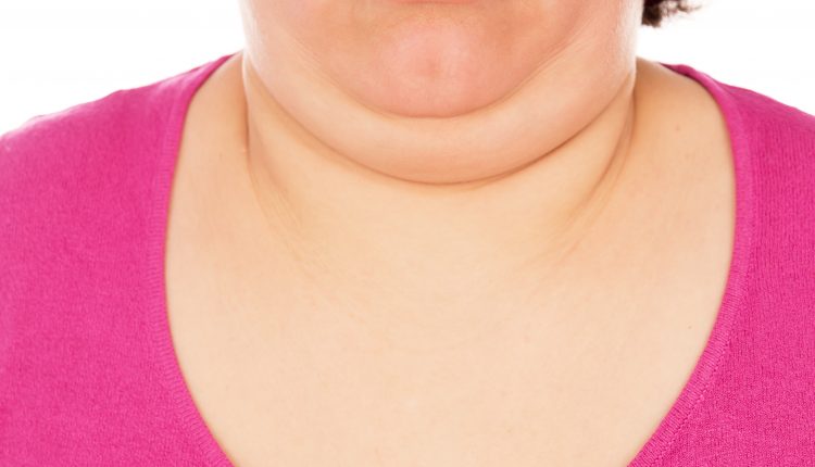 Full woman shows the second chin