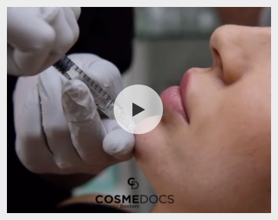 Dermal Filler Tretment Video