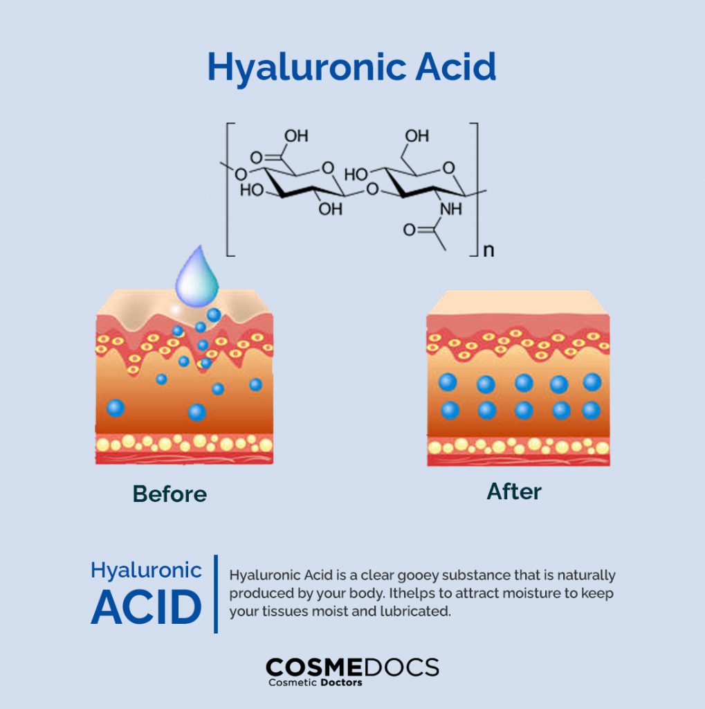 Hyaluronic Acid effects on skin