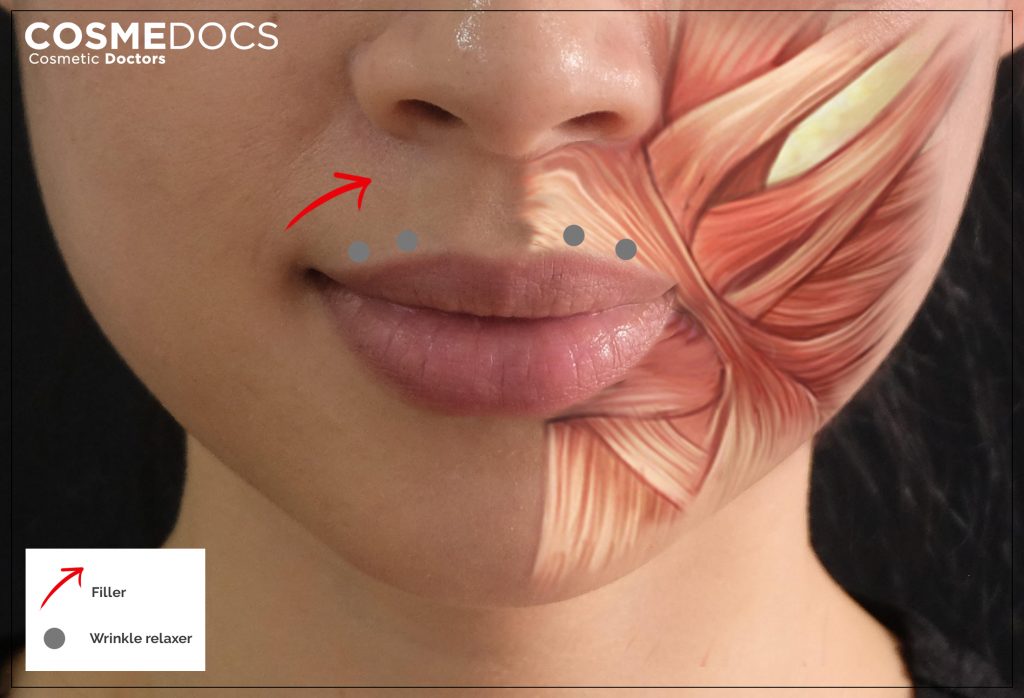 lip muscle illustration