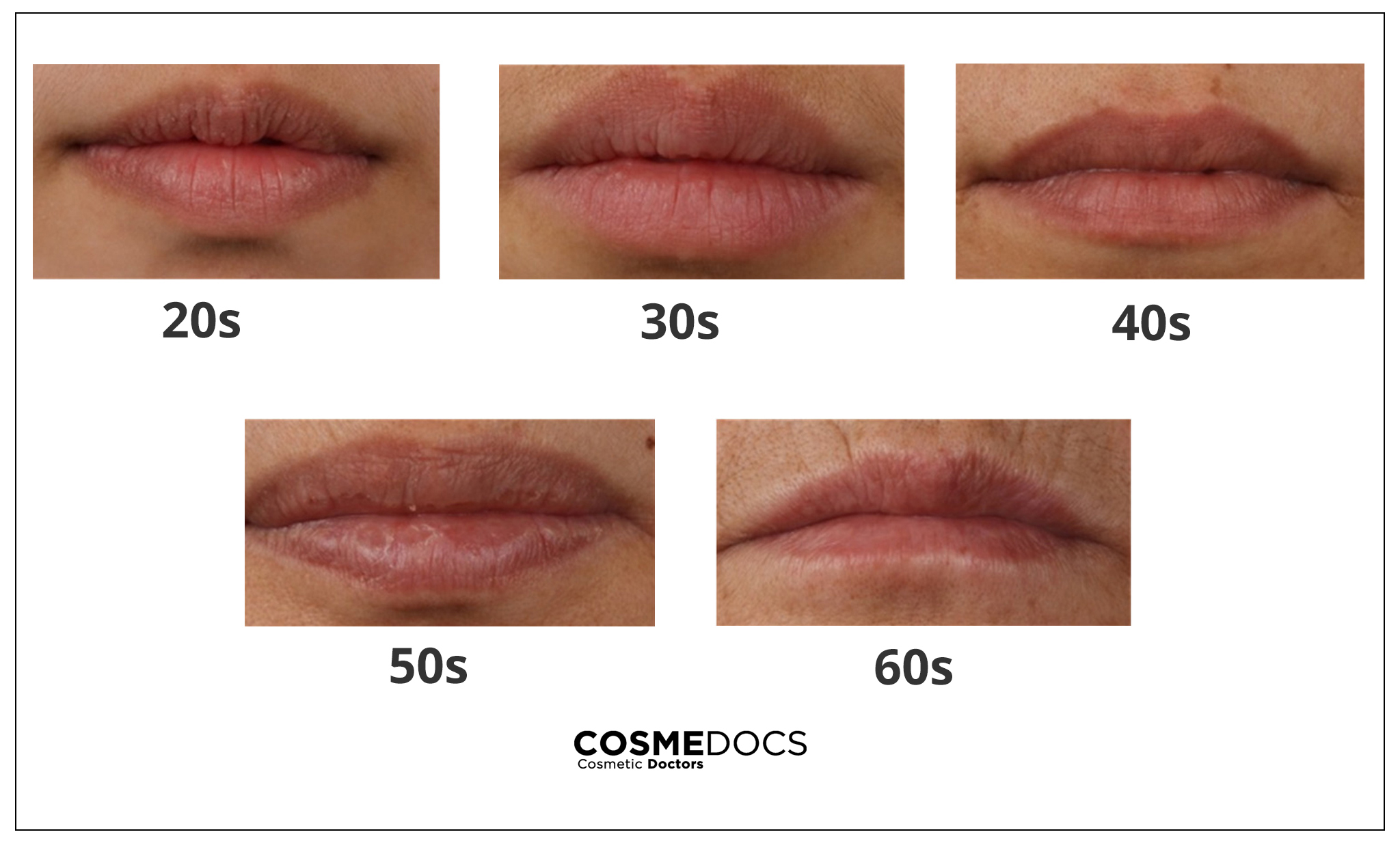 lips aging