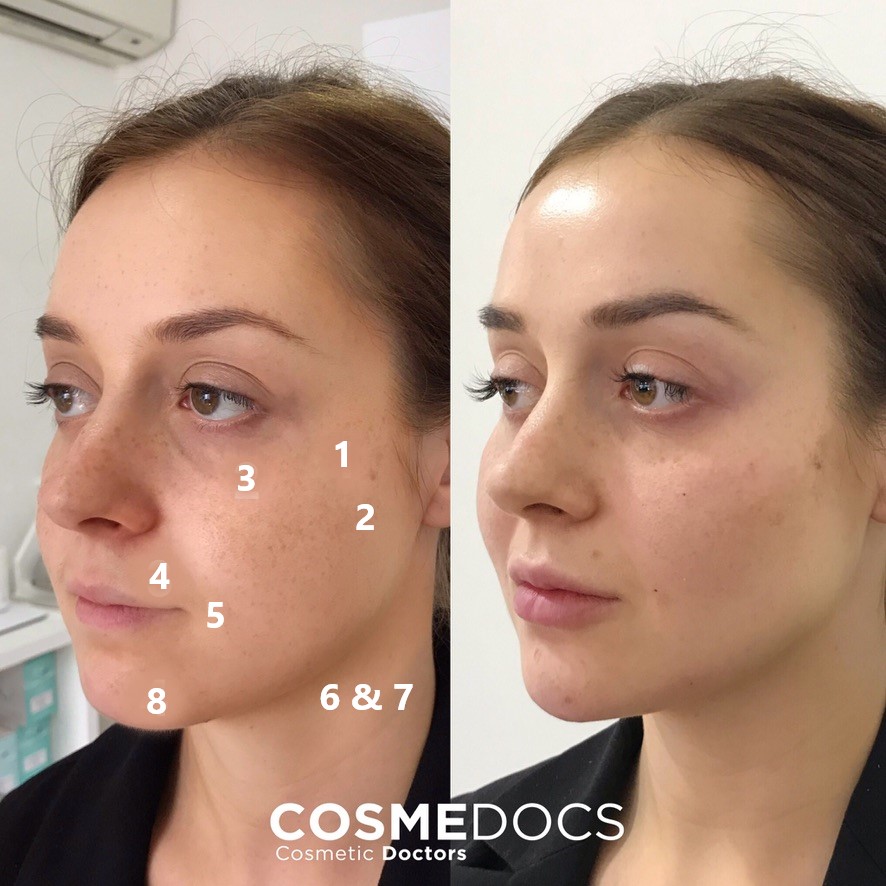 Fake a Facelift in 5 Minutes with this Contour Technique