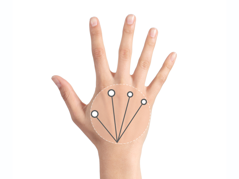 profhilo treatment for hand