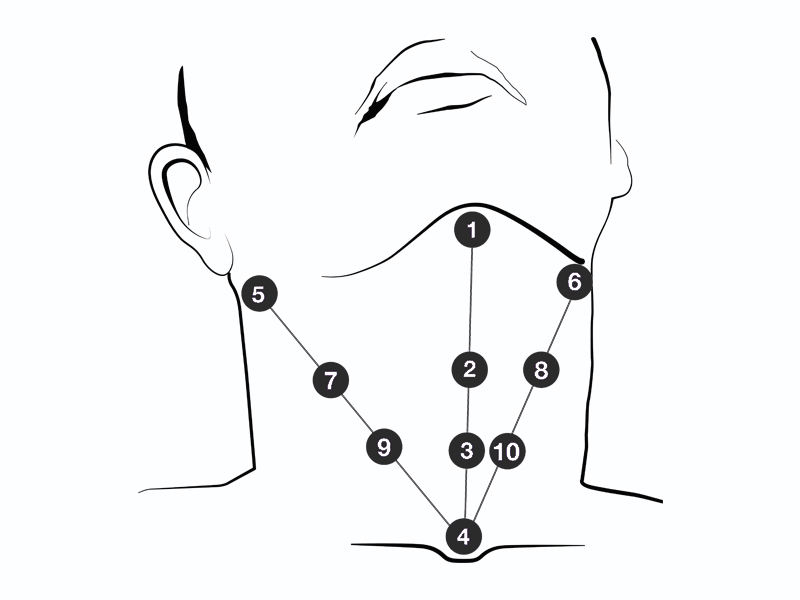 profhilo treatment for neck