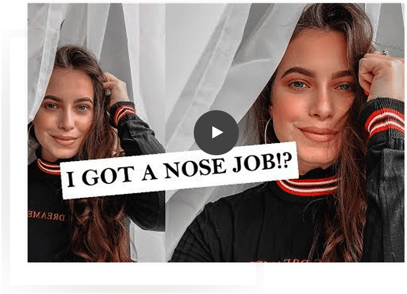 Non Surgical Nose Job Video