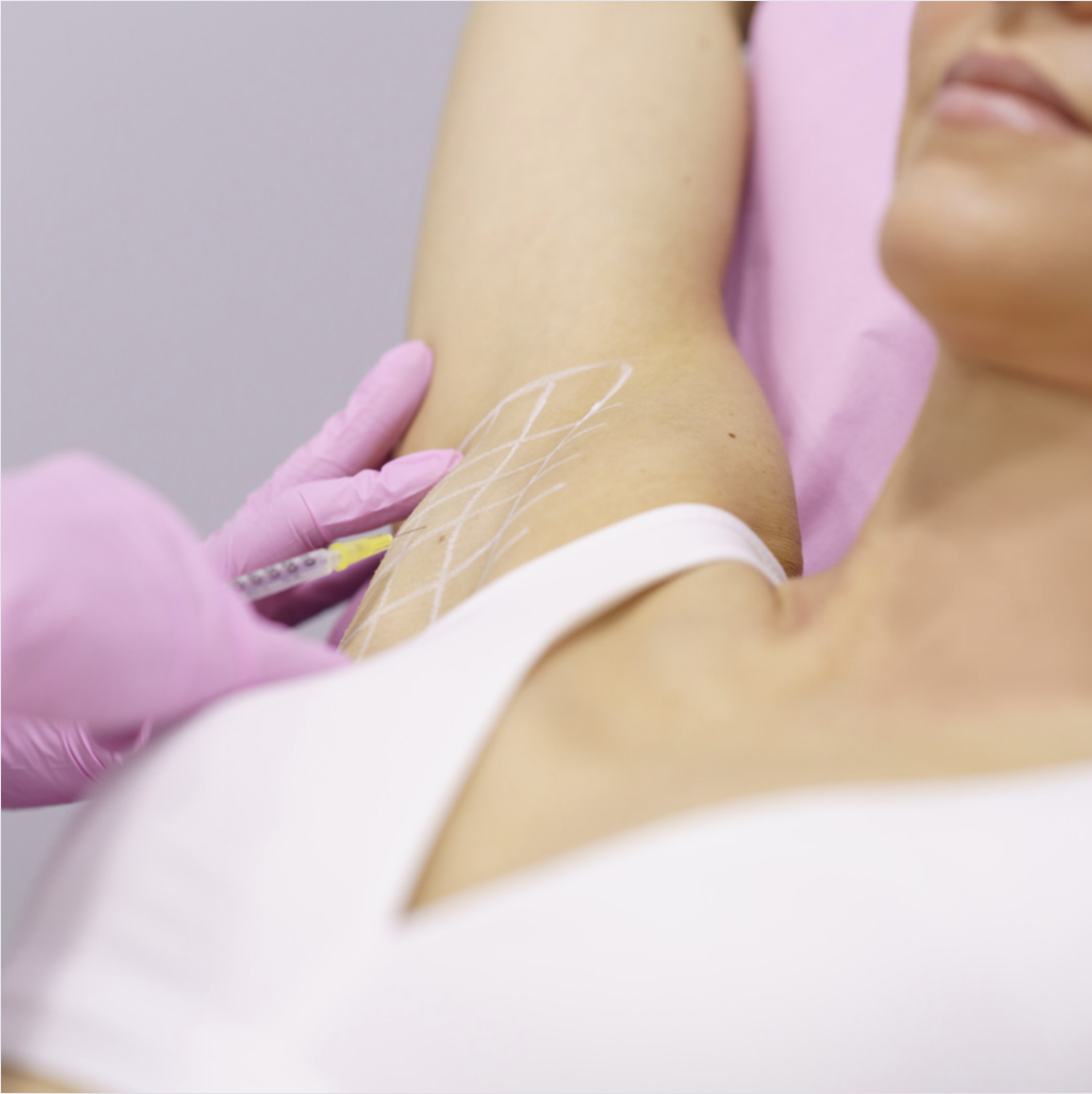 botox in armpit picture showing injections